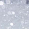 雪のワルツ